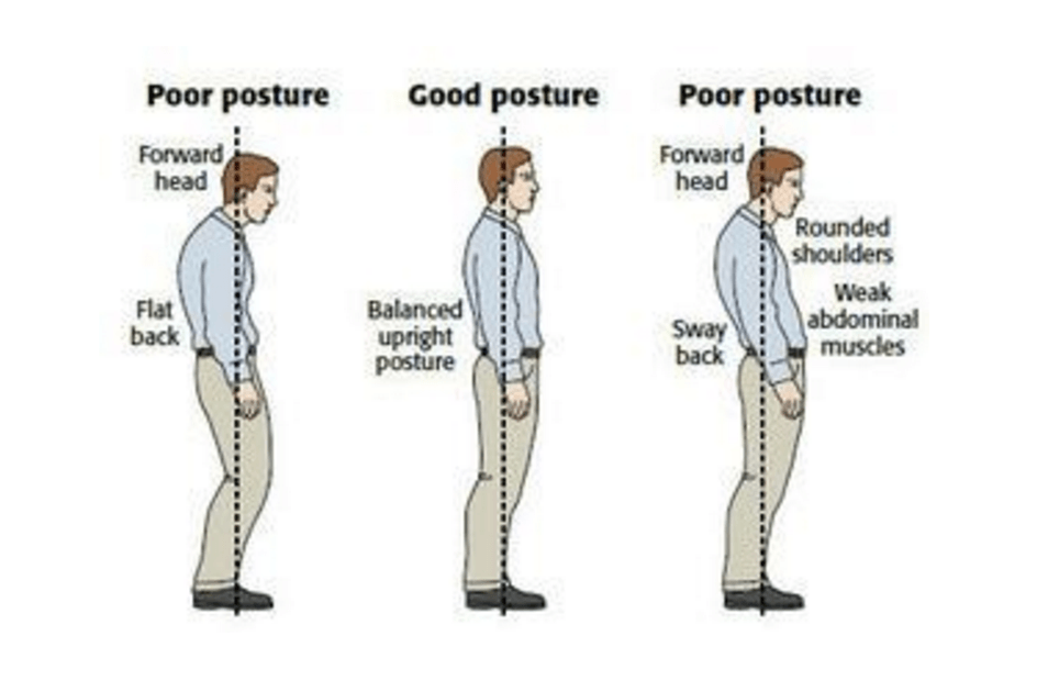 圖片來源：http：//www.thephysiocompany.com/blog/stop-slouching-postural-dysfunction-symptoms-causes-and-treatment-of-bad-posture