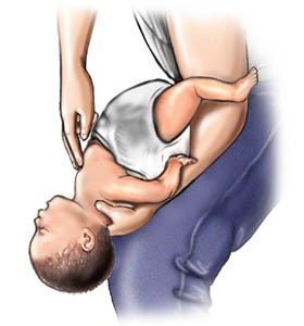 幫助窒息嬰兒的步驟（4-5）來源：www.webmd.com