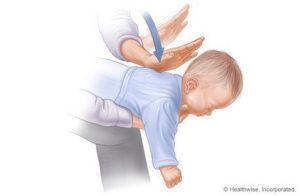 幫助窒息嬰兒的步驟（1-3）來源：www.webmd.com