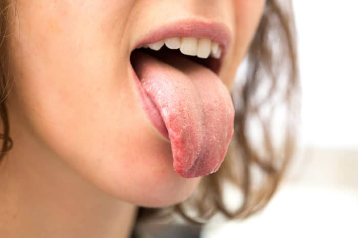 舌癢的原因