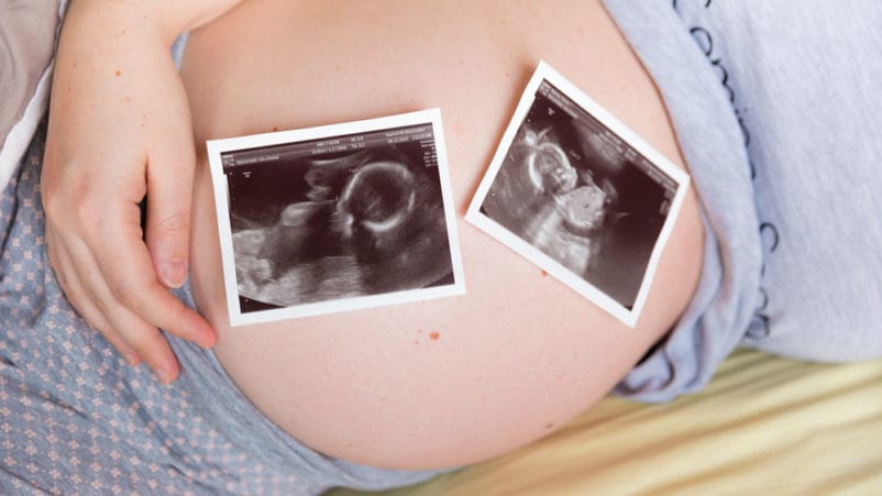 雙胞胎懷孕的風險消失了