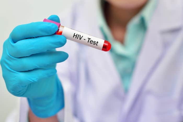 HIV血液檢查