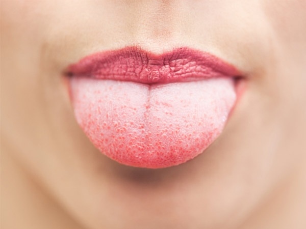 舌頭的顏色表示疾病